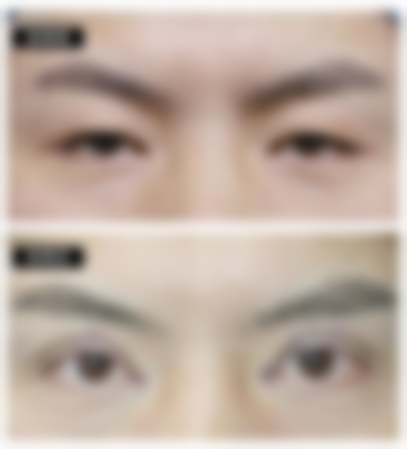 无锡爱思特整形美容医院如何正规吗？