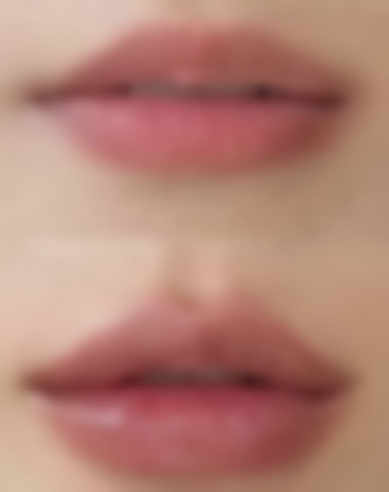 漳州维多利亚医疗美容门诊部陈淑端医生眼部整形技术怎么样？