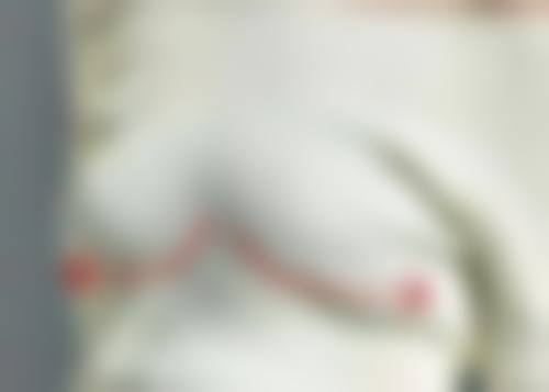 惠州市中 心人民医院(整形美容激光中 心)口碑评价怎么样？