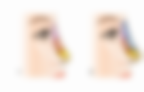 株洲市一医院烧伤整形科正规吗？