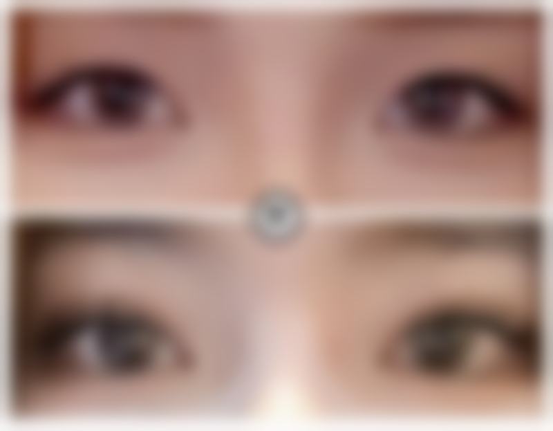 这些受欢迎的隆鼻医院的医生有什么优势？