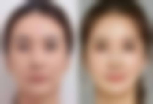 手术治疗适用于什么情况？