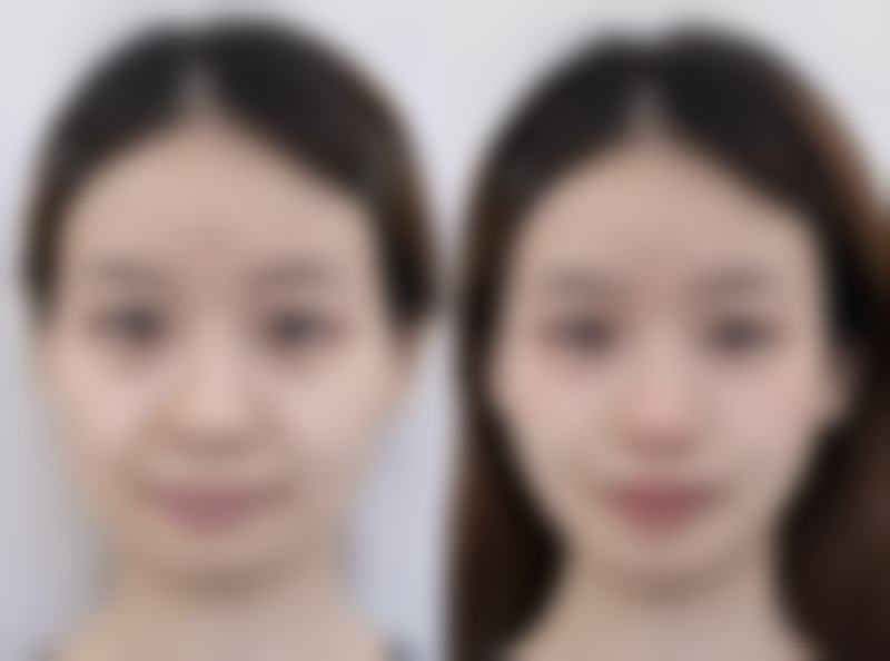 玉林悦目医疗美容诊所怎么预约