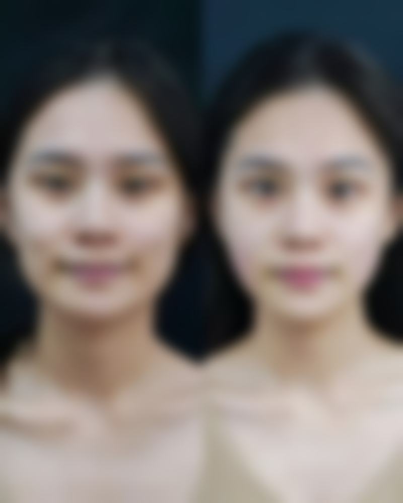 术后修复有哪些阶段，每个阶段有什么特点？