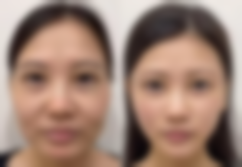 玉林悦目医疗美容诊所正规吗？