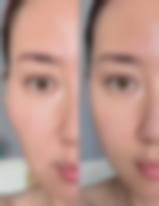 韩国BR贝乐居私密整形医院正规吗？