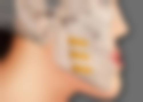 济南韩城整形美容医院刘同省医生患者评价