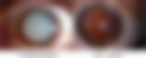 怎么样能去痘痘的疤痕？专家推荐的5种有效方法揭秘！这些方法效果究竟如何？ 