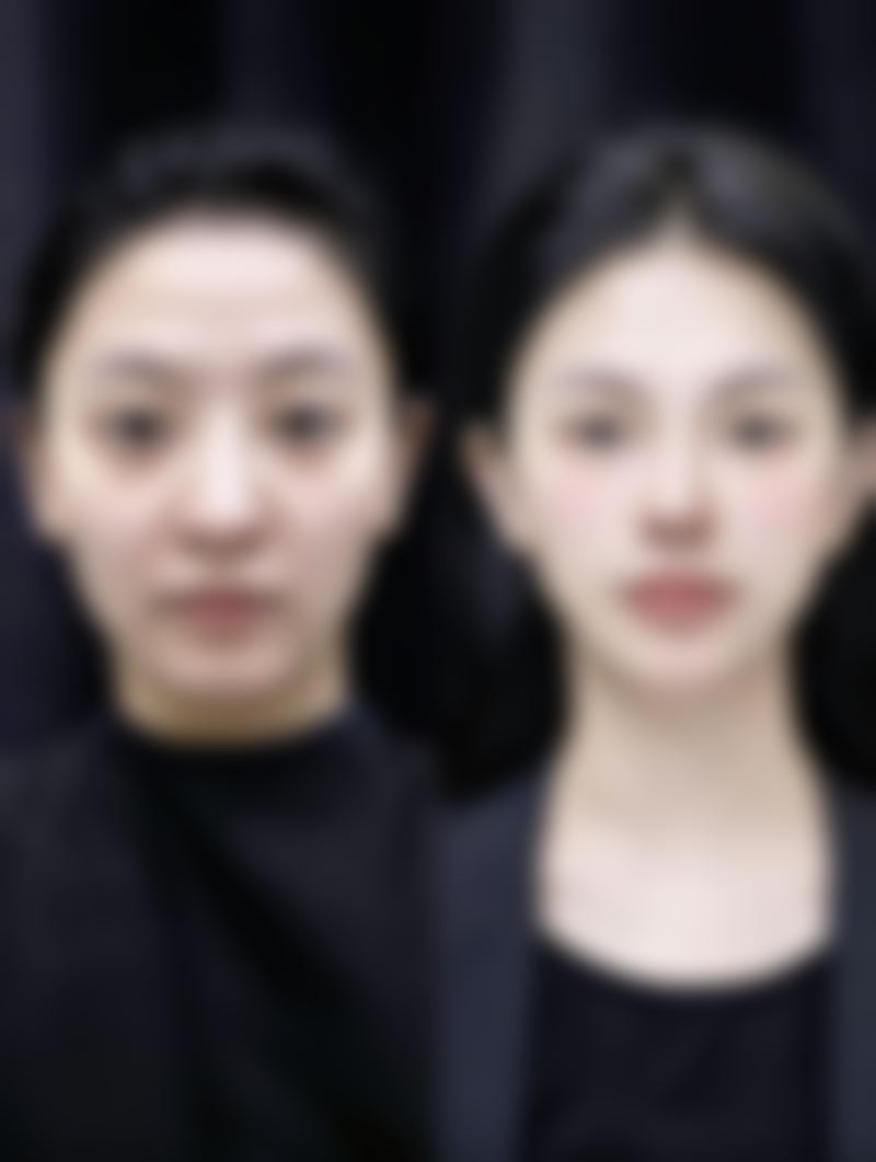 alive皮肤科医院怎么预约