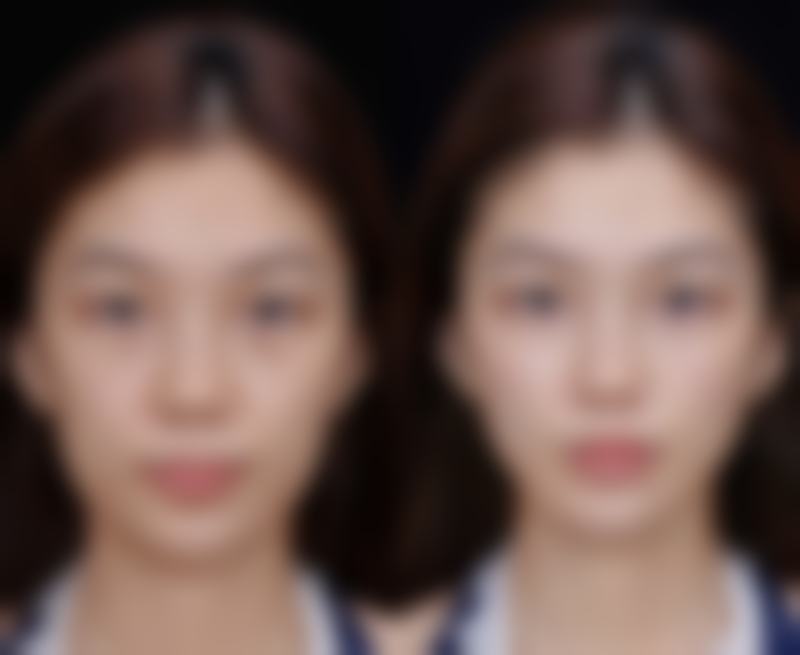 济南韩城整形美容医院刘同省医生擅长项目