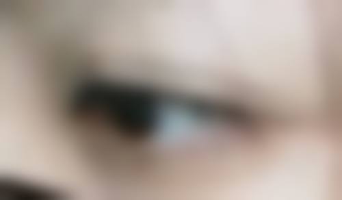 那快来例假时做双眼皮手术还有其他什么风险吗？