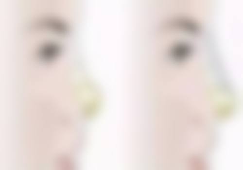 成都镜禧医疗美容诊所正规吗?