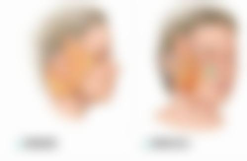 北京京民医院（原钓鱼台医院）整形外科李鸿儒医生患者评价