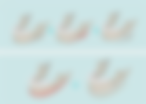 问题五：第二步的三角贴法敷贴具体是怎样操作的呢？