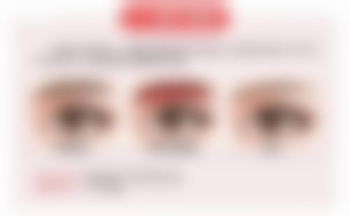 成都朗睿医疗美容诊所尹丹医生预约挂号指南