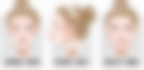 九、日常护理对改善颧骨宽有帮助吗？有哪些建议？