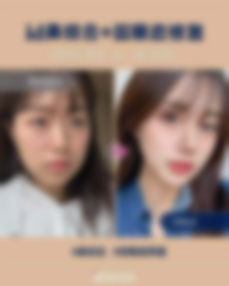 成都朗睿医疗美容诊所尹丹医生擅长项目