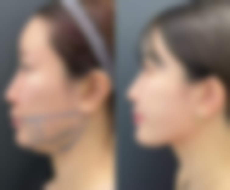 重庆郑荃丽格青春医美门诊部怎么预约