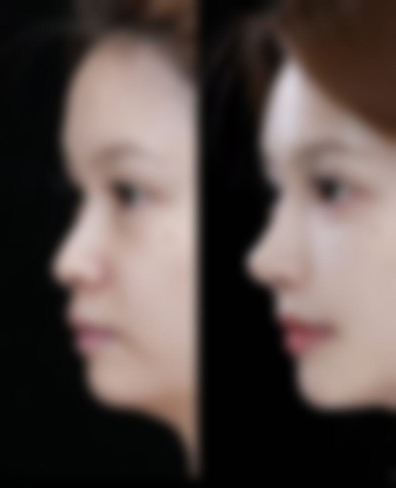 沈阳医 科 大学附属第一医院总院郭澍医生患者评价