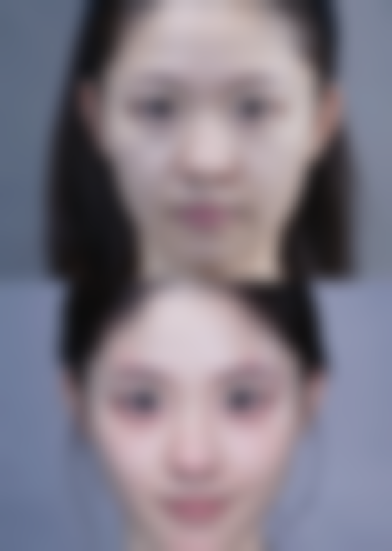 济宁医莱美玖愿整形医院口碑评价怎么样?