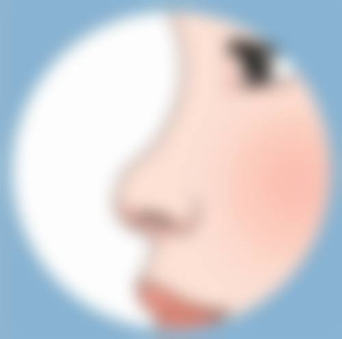 扁平性疤痕能完全修复成正常皮肤吗？