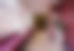 北京五洲整形医院黄爱芳医生患者评价