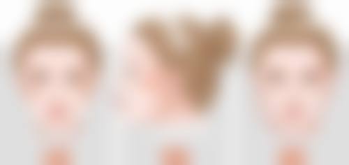 南方医 科 大学附属南方医院(泰成逸园分院)整形美容科黄广涛医生擅长项目