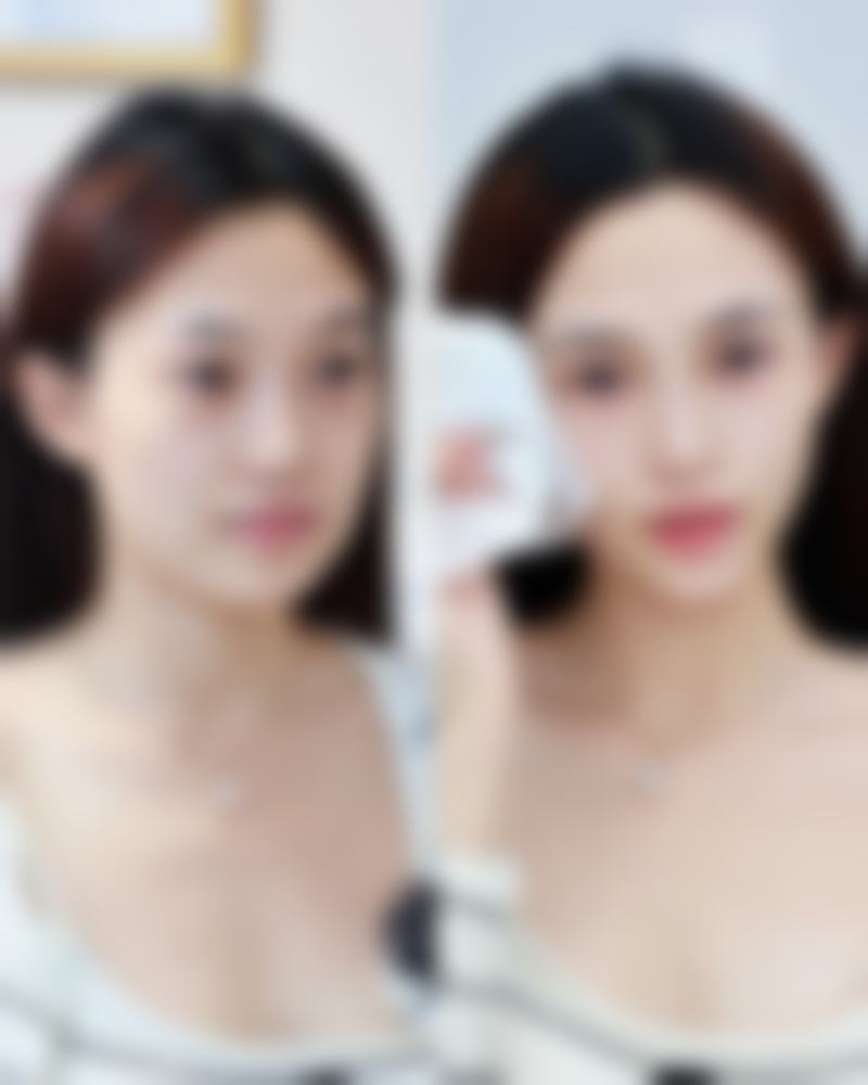 深圳梅奥锋范医疗美容门诊部正规吗？