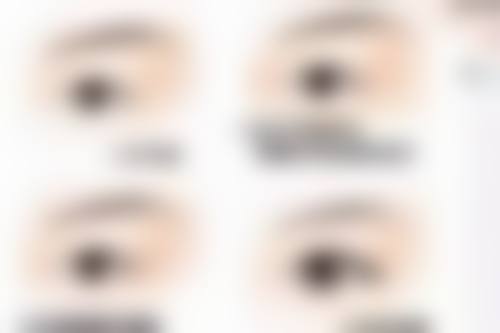 修复期是如何划分阶段的？