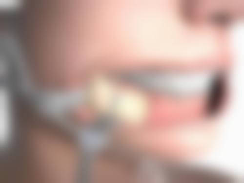 海口慢拾光医疗美容诊所庄姮医生牙齿美容技术怎么样？