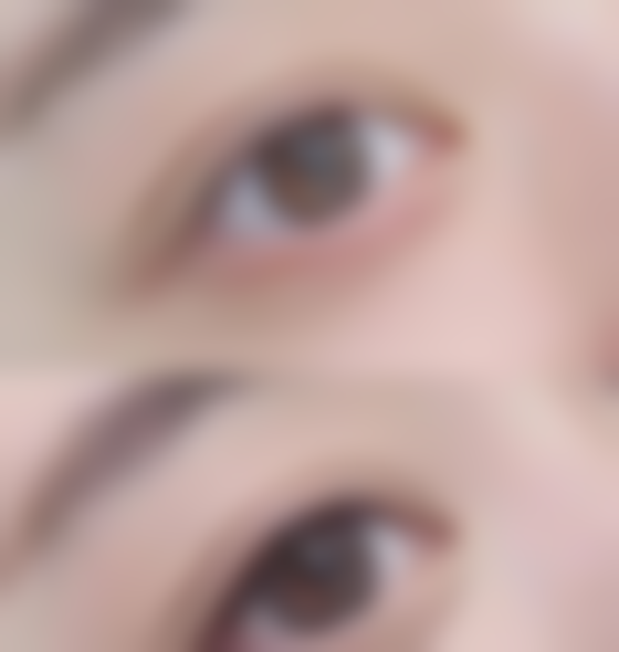 包头鹏爱悦己悦心医疗美容门诊部正规吗？