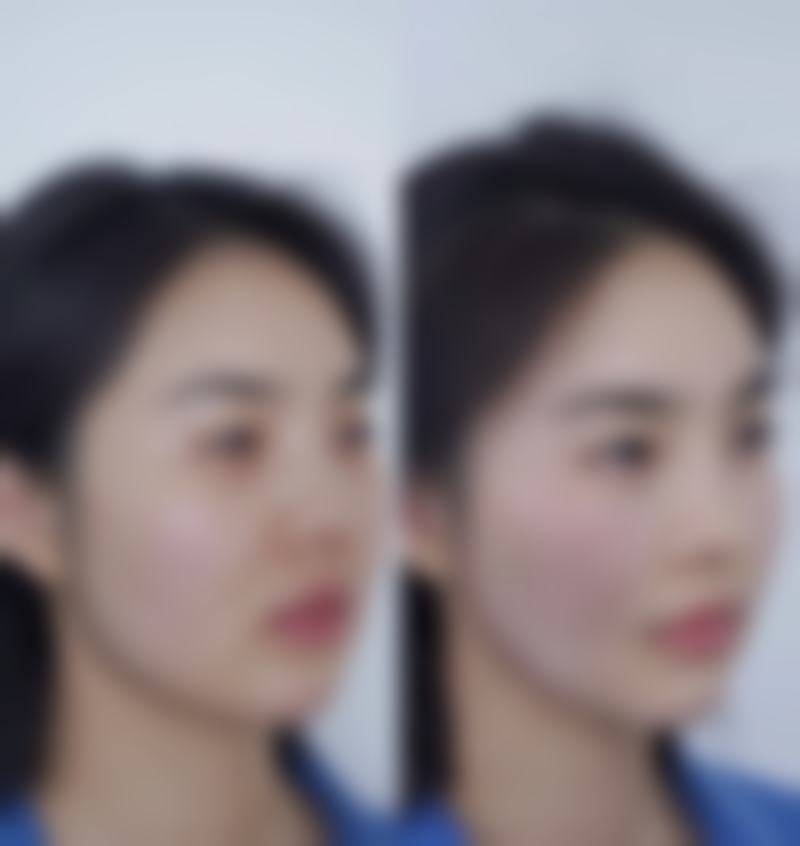 济南历城贝拉整形医院怎么预约