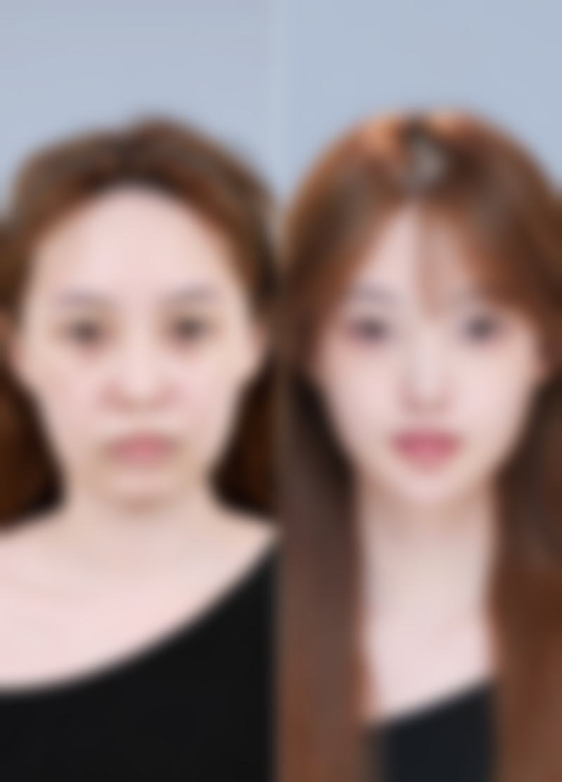 南昌鹏爱美容整形医院彭蔚医生擅长项目