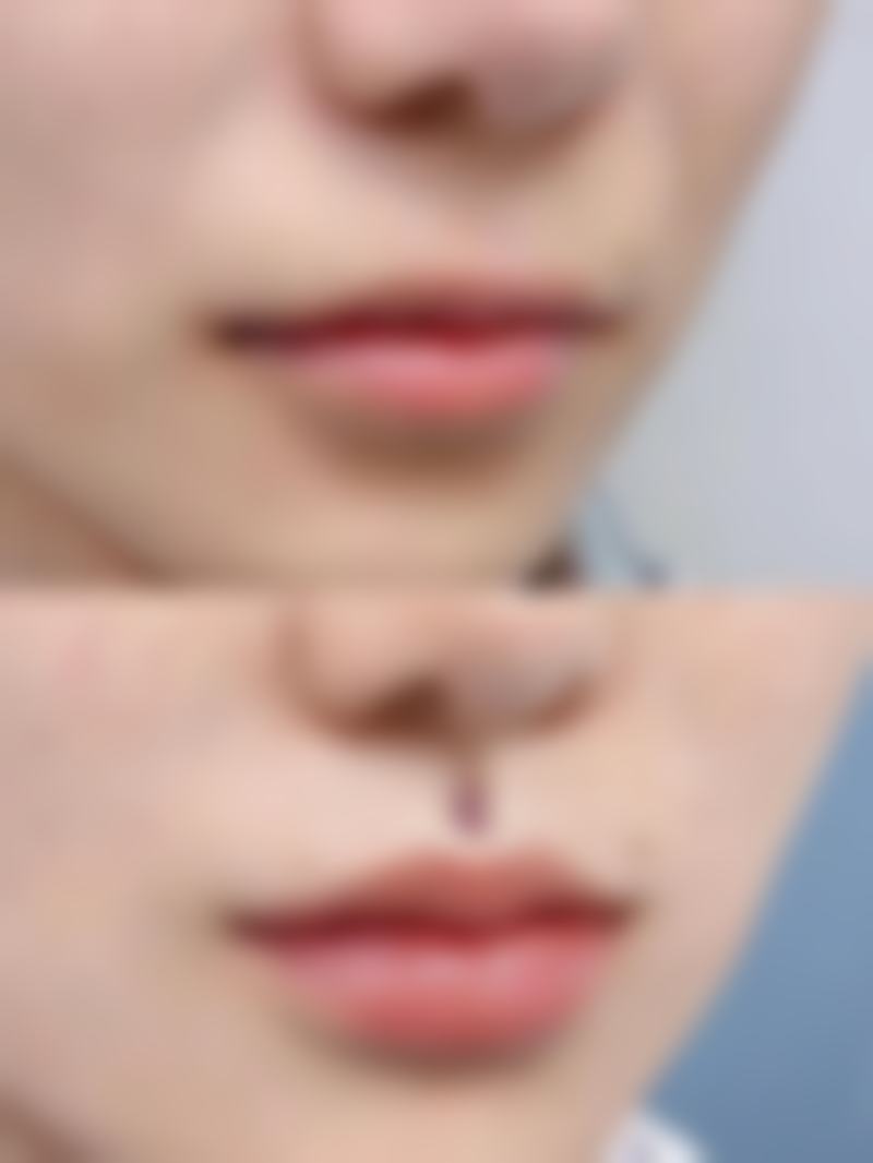 包头鹏爱悦己悦心医疗美容门诊部收费价格表