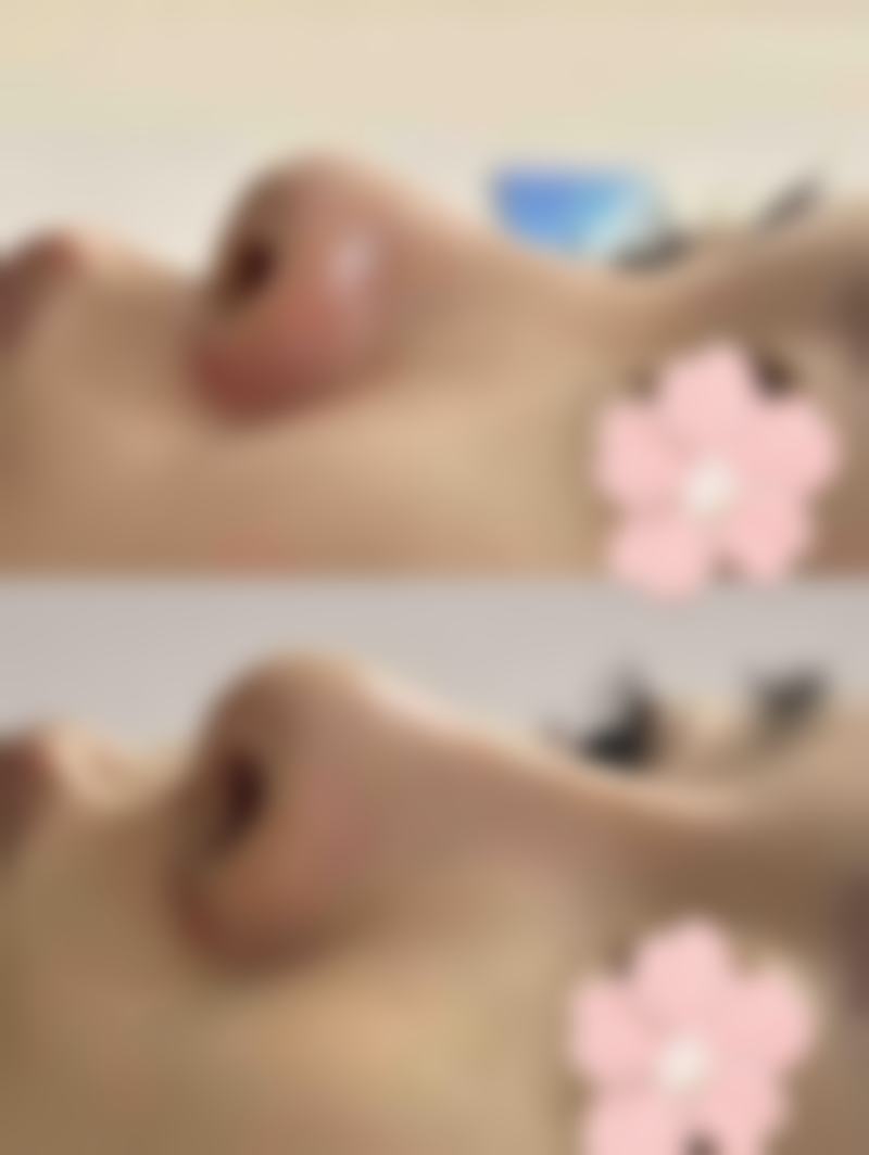 南昌鹏爱美容整形医院彭蔚医生患者评价