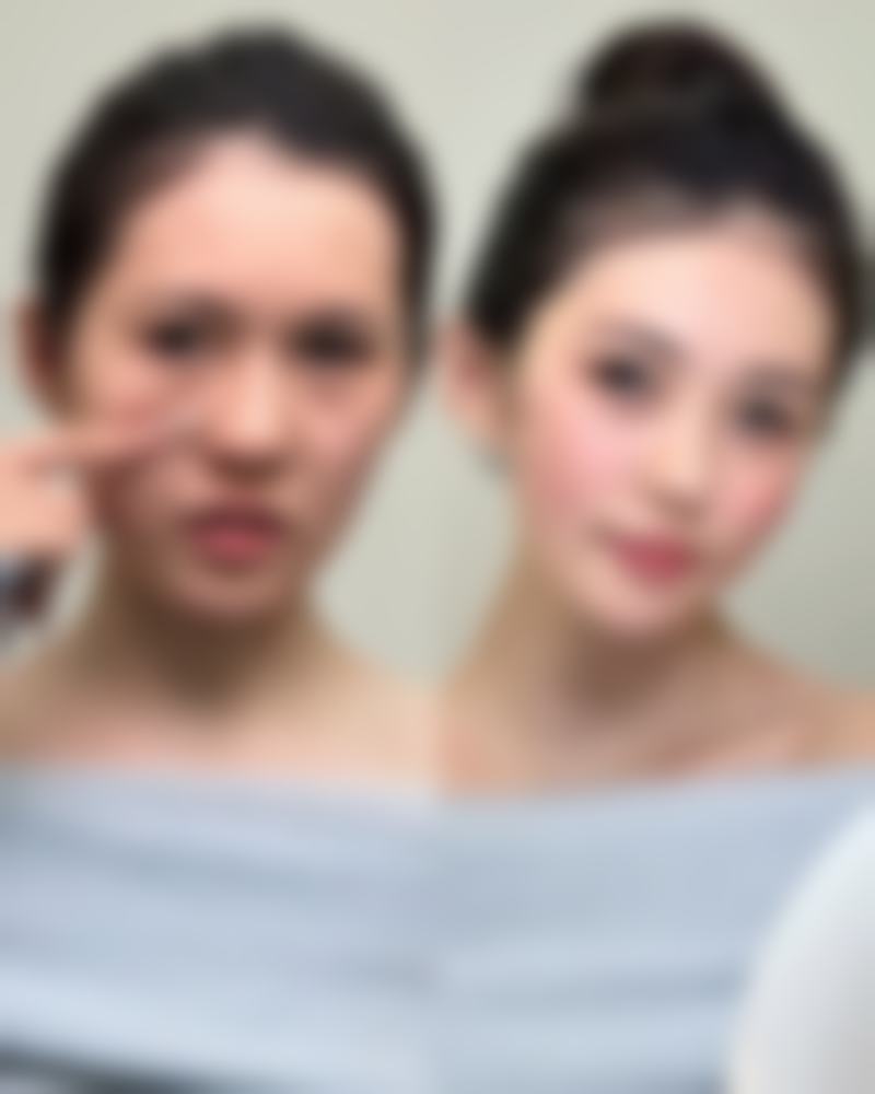 哪些人不适合抽脂减肚子？