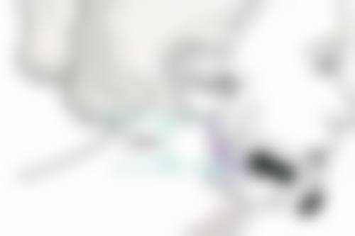 熬夜和睡前喝水多是眼袋浮肿的主因吗？