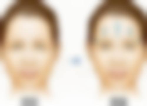 广州尚美善造医疗美容门诊部朱晓东医生擅长项目