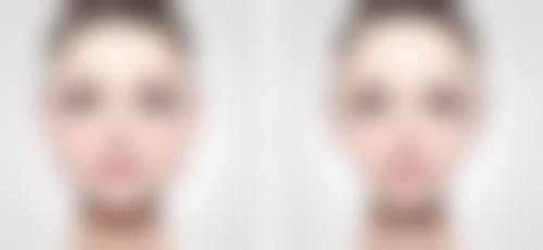 阜阳黛莱美医疗整形美容医院正规吗？