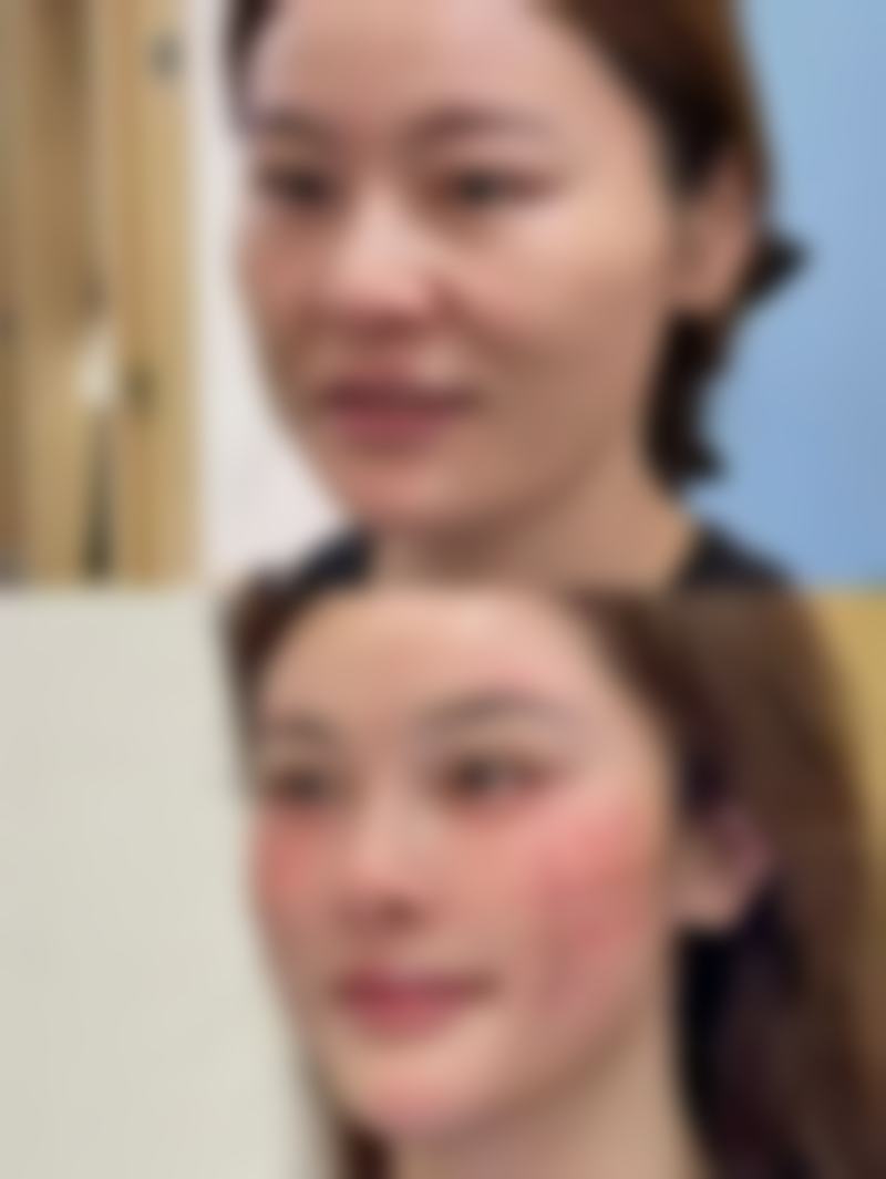 洛阳班爱荣医疗美容诊所口碑评价怎么样？