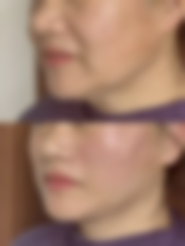 长沙伊百丽医疗美容门诊部赵江茹医生患者评价