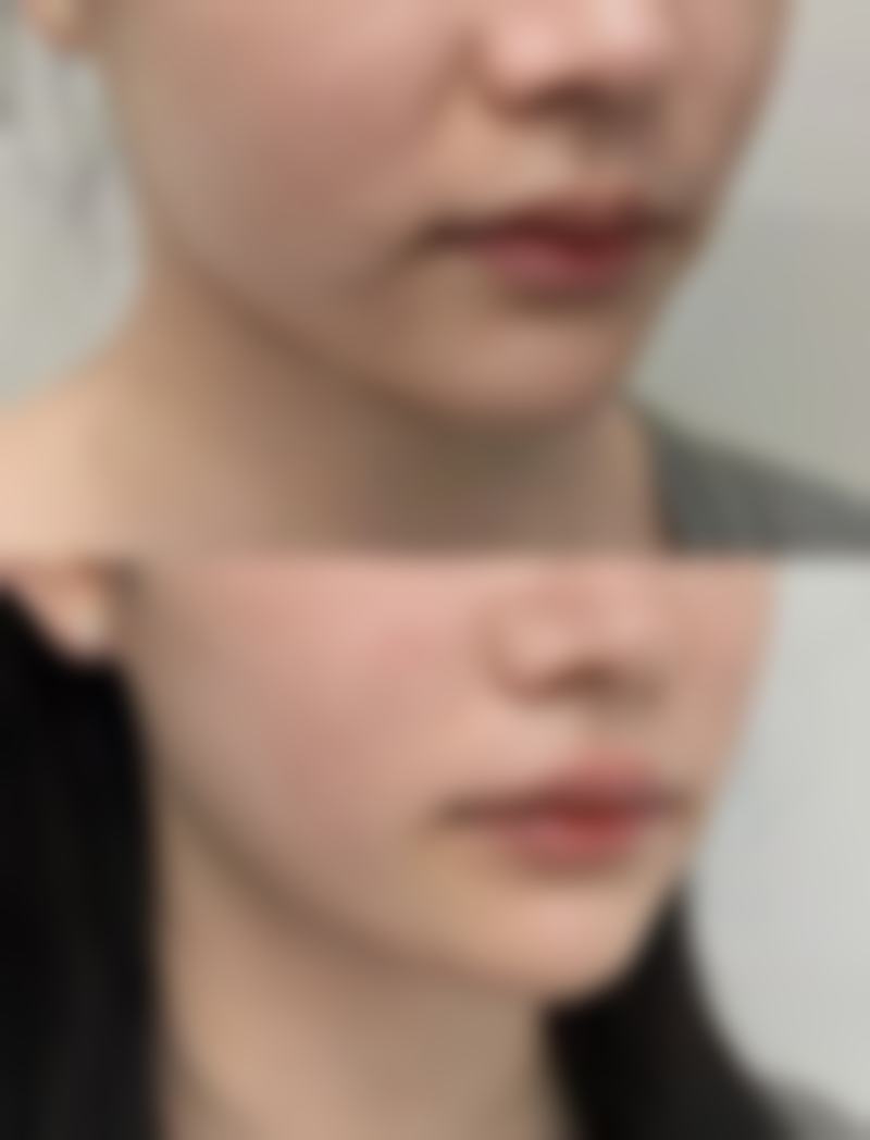 天门市第一人民医院整形美容科正规吗?