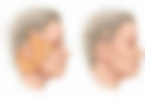 骨干医生解析真实实例