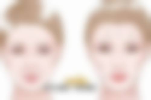 注射隆鼻成效持久吗？