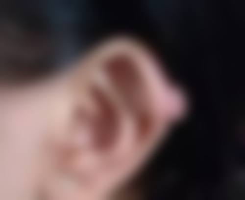 注射隆鼻效果怎样？专家解析真实案例与注意事项！效果持久吗？有啥副作用？ 