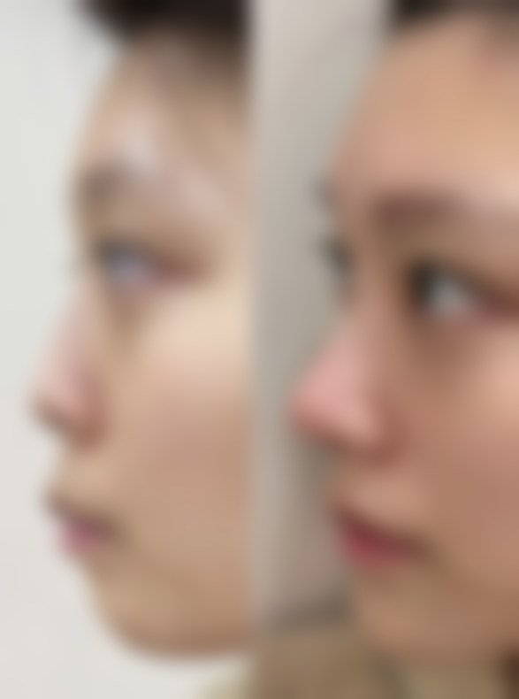 三明市永安总医院医疗美容科收费价格表