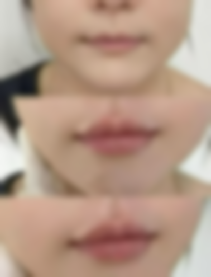 东莞长安新安医院医学整形科怎么预约