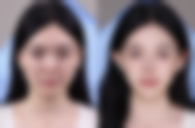 哈尔滨禾力康医疗美容医院刘亚春医生色斑皮肤治疗技术怎么样？