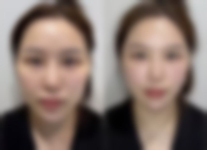 洛阳生殖医学专科医院整形科刘社红医生擅长项目