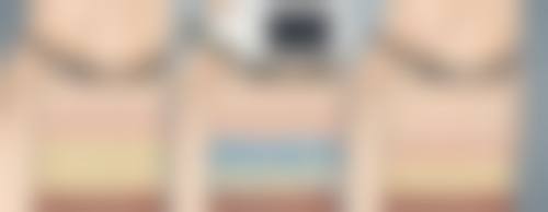 问题三：医美与手术治疗方案中，针对不同类型的黑眼圈有哪些治疗方法？